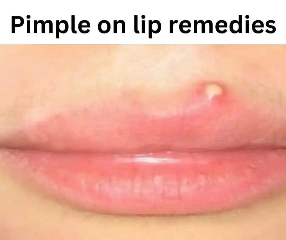 pimple on lip